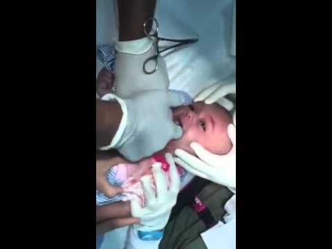 بالفيديو: شاهد أطباء في مستشفي بجدة يخرجون ساعة من حلق طفل