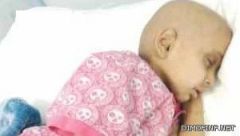 أطباء التخصصي: راما غير مصابة بالسرطان