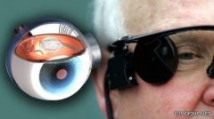 “العين الإلكترونية” فرصة جديدة للمصابين بالعمى