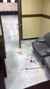 إصابة 11 شخص بمشاجرة في مستشفى الملك خالد بحائل