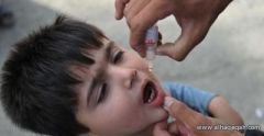 شلل الأطفال مرتبط بفيروس الجهاز التنفسي الحاد في الولايات المتحدة
