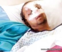 الأردن يحقق في وفاة شاب سعودي بعد خضوعه لجراحة بسيطة في أنفه