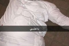 الاعتداء على مواطن عشريني في القطيف بدعوى انتمائه لداعش