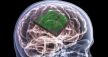 “#الغذاء_والدواء” الأمريكية توافق على أول تجربة لزراعة شريحة إلكترونية في دماغ الإنسان