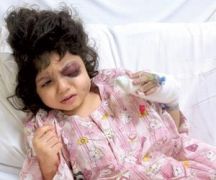 عُمان: استخراج الرصاصة من رأس الطفلة السعودية “زينب” بعد جراحة استمرت لأكثر من ساعتين