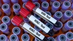 #بريطانيا ترصد أول حالة بشرية مصابة بأنفلونزا مشابهة لفيروس يصيب الخنازير