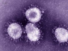 الصحة : إصابة “سبعينية” وشفاء حالتين من فيروس “كورونا” في جدة والرياض